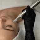 Limpieza facial + Dermapen